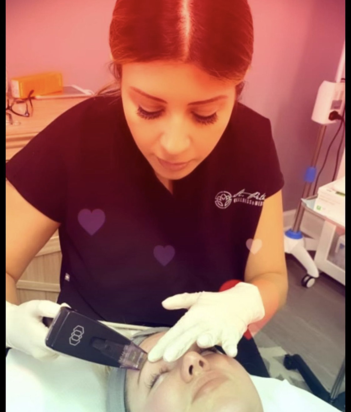 A provider performing a precise facial microneedling treatment at St Pete Wellness Med Spa